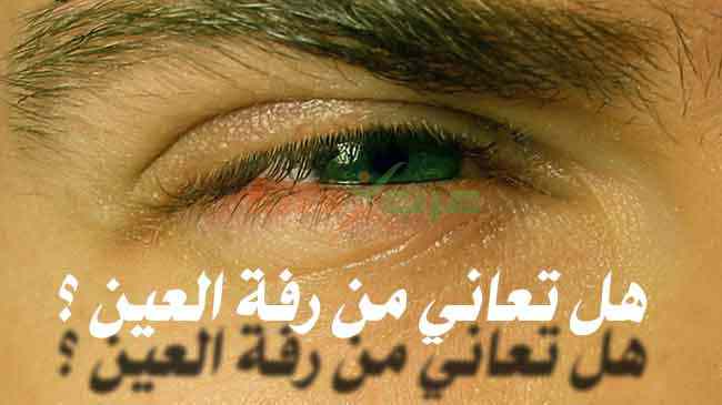 رفة العين ما هي أسباب رفة العين وهل هي مرض يستدعي العلاج